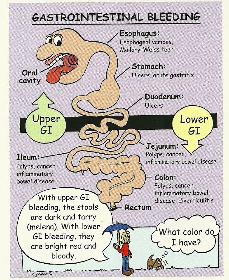 Gastrointestinal GI Bleeding Symptoms Treatment Risk Factors