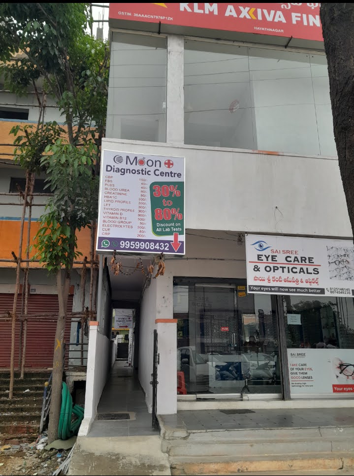 Moon Diagnostic Centre And Clinic from Moon Diagnostic Centre And Clinic 4-7-102/1 - beside bajaj electronics - r r district - hyderabad  ,Hyderabad ,Telangana, India | Kayawell