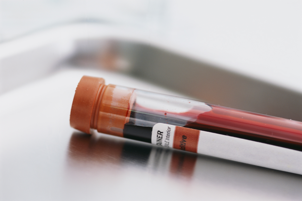 Liver blood tests