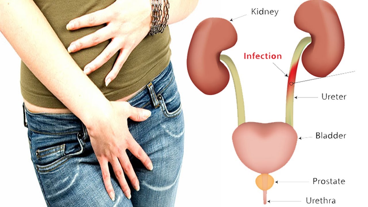 Urinary Tract Infection Meaning In Hindi Andre