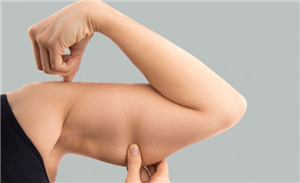5 Exercises For Flabby Arms That Every Woman Should Try
