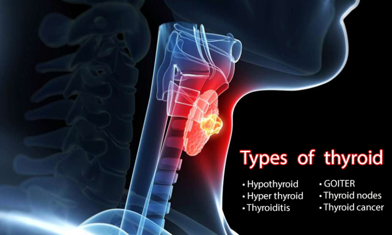 What are the thyroid and its symptoms | Kayawell