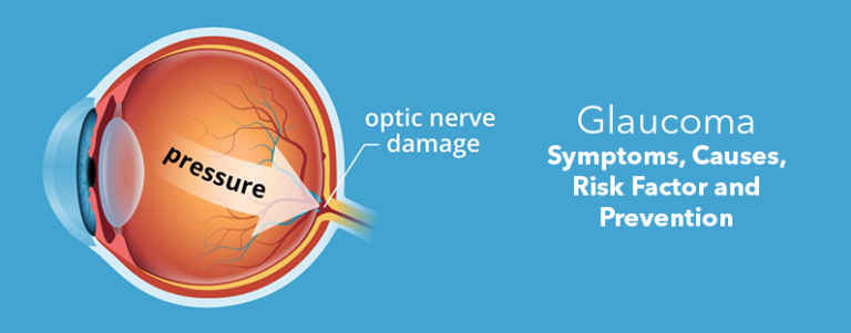 Glaucoma Symptoms Causes Risk Factor And Prevention