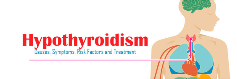 Hypothyroidism