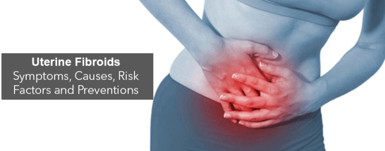 Uterine Fibroids- Symptoms, Causes, Risk Factors and Preventions