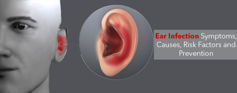 Ear Infection Symptoms Causes Risk Factors And Prevention Kayawell 7554