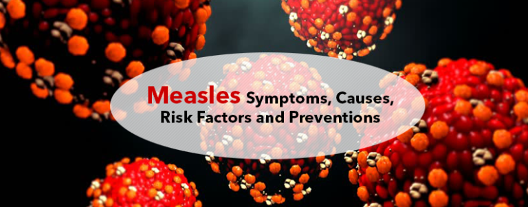 Measles Symptoms Causes Risk Factors And Preventions Kayawell 7256