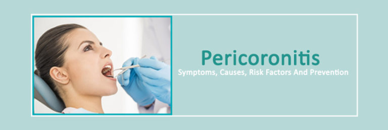 Pericoronitis