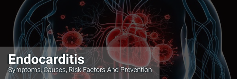 Endocarditis--Symptoms,-Causes,-Risk-Factors-And-Prevention