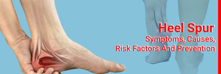 Heel Spur- Symptoms, Causes, Risk Factors And Prevention