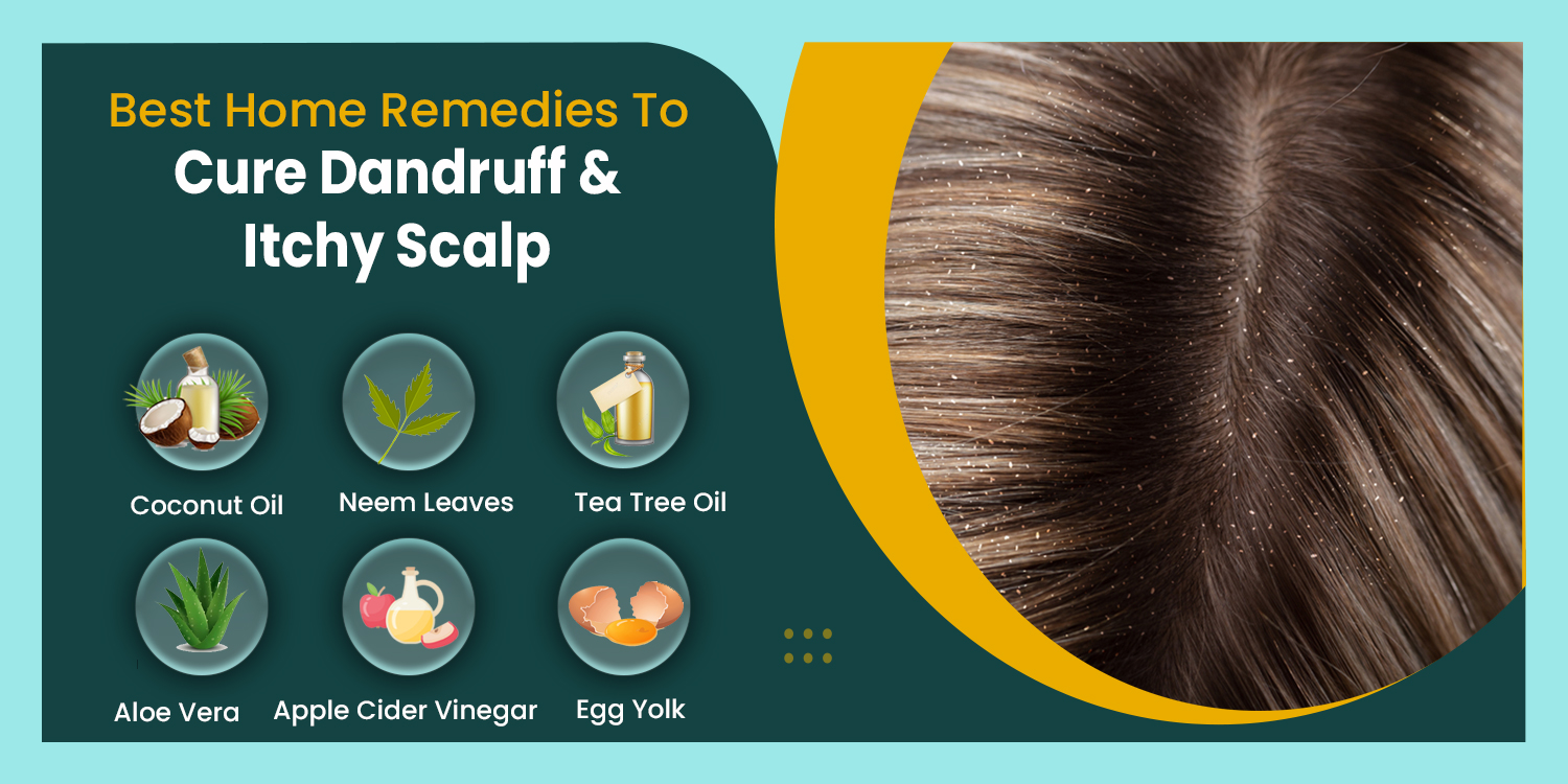 Natural remedies to get rid of dandruff