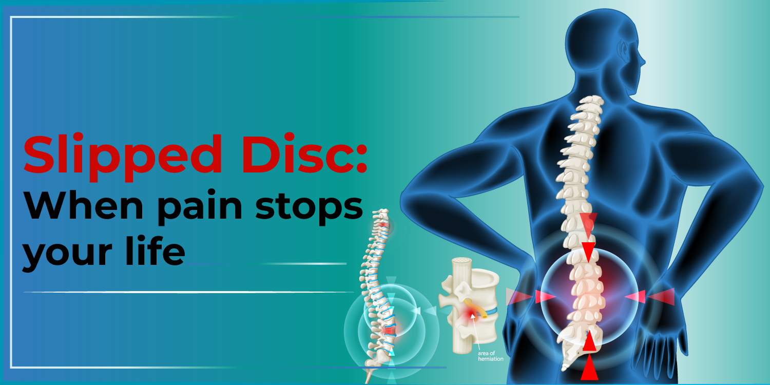 Slipped Disc Symptoms KayaWell