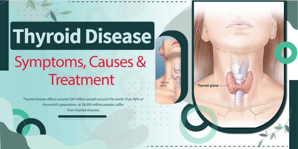 understand-4-possible-ways-to-cure-thyroid-permanently