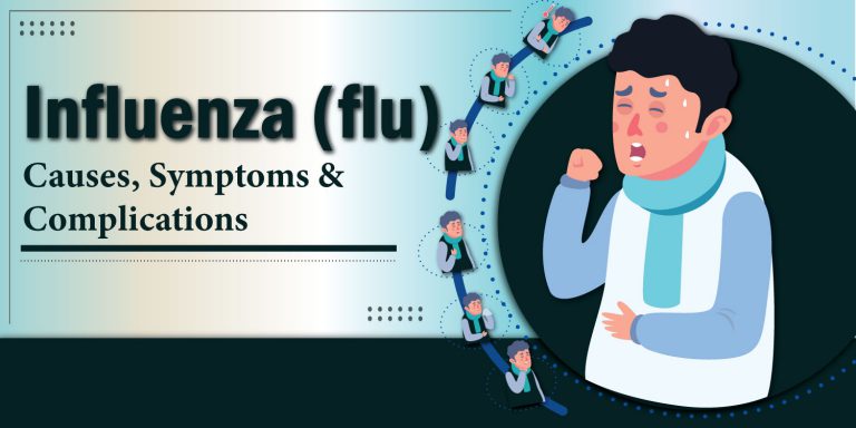 influenza symptoms