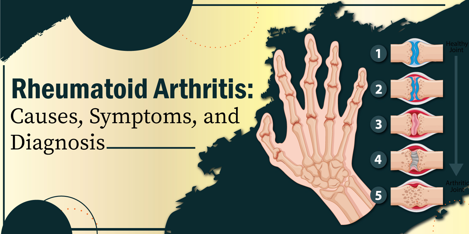 Rheumatoid Arthritis Causes Symptoms And Diagnosis