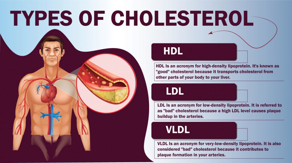 High Cholesterol Symptoms Cause Risk Factor Kayawell